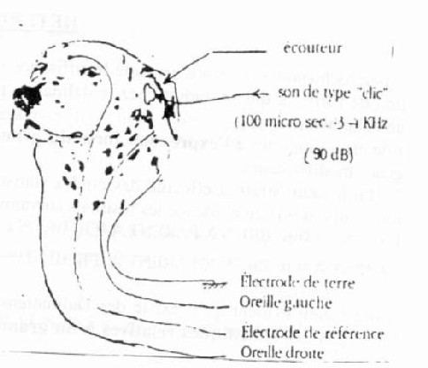 Surdité héréditaire. En attendant, les tests génétiques, l'enregistrement des PEA est incontournable. Surdité héréditaire. En attendant, les tests génétiques, l'enregistrement des PEA est incontournable.